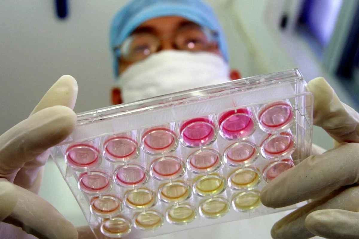 तस्बिर: एपी