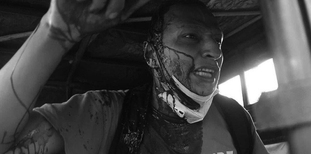 प्रहरी कुटपिटबाट शुक्रबार घाइते भएका श्रेष्ठ।