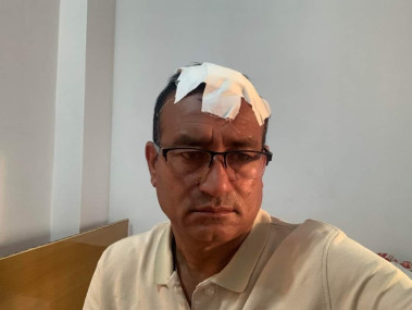 सल्यान जिल्‍लाका कांग्रेस सभापति केशबहादुर विष्ट।
