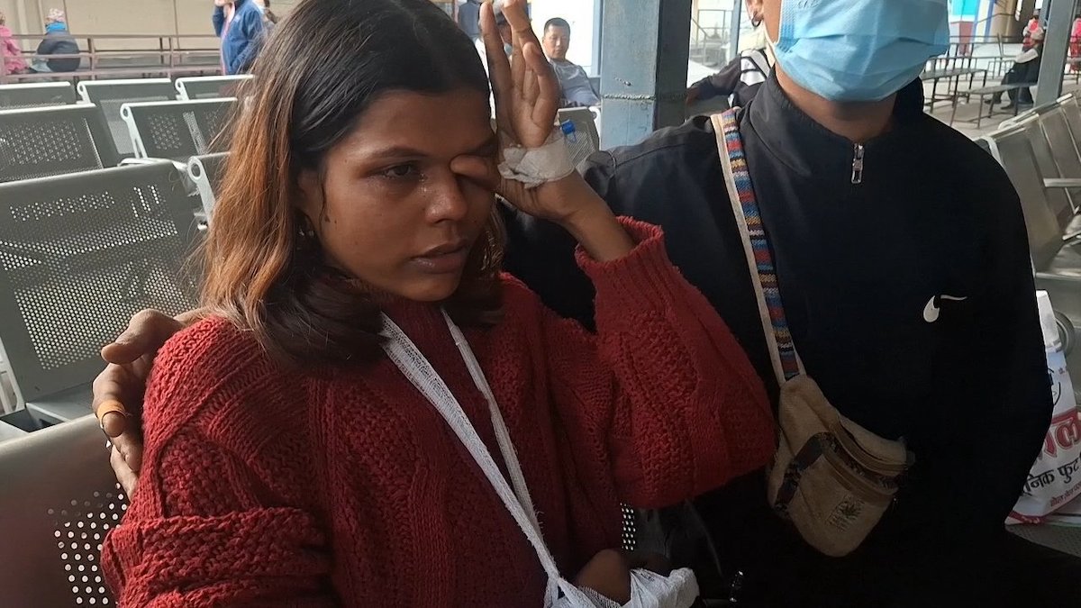 बुटवल आइपुगेकी घाइते यात्रु रिचाई योगी।