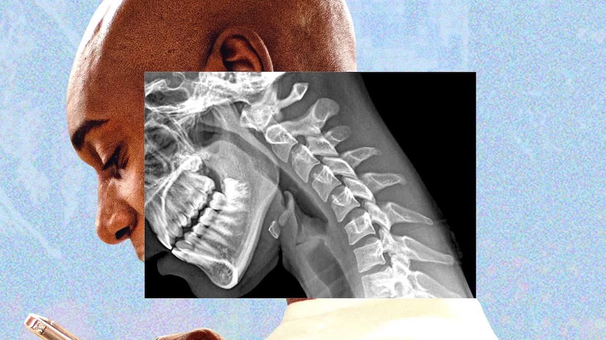 Tech-neck1-1782899168.jpg